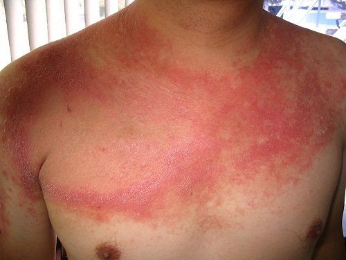 11 lý do có thể giảm cân không giải thích được