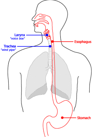 Bệnh hen suyễn do trào ngược dạ dày thực quản