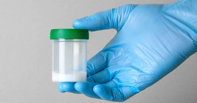 13 sự thật về tinh dịch và tinh trùng: Thành phần, khối lượng