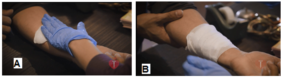 Cách sơ cứu khi bị vết thương gây chảy máu bên ngoài