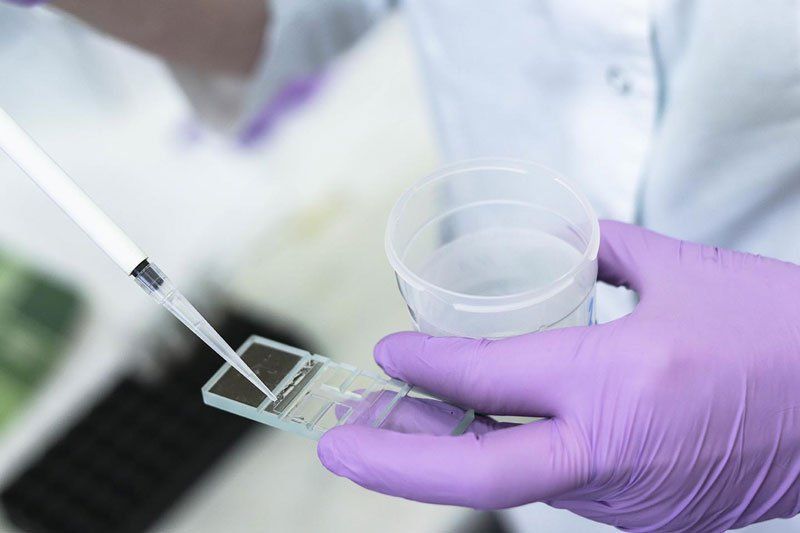 Xét nghiệm phân mảnh DNA tinh trùng trong chẩn đoán hiếm muộn
