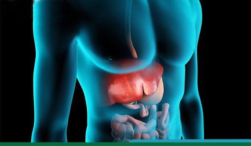Thuốc Atovaquone: Công dụng, chỉ định và lưu ý khi dùng