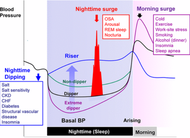 Các phương pháp đo huyết áp tốt nhất để phát hiện tăng huyết áp về đêm?
