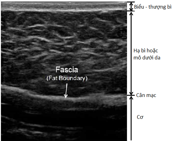 Các đặc điểm hình ảnh học của viêm mô tế bào