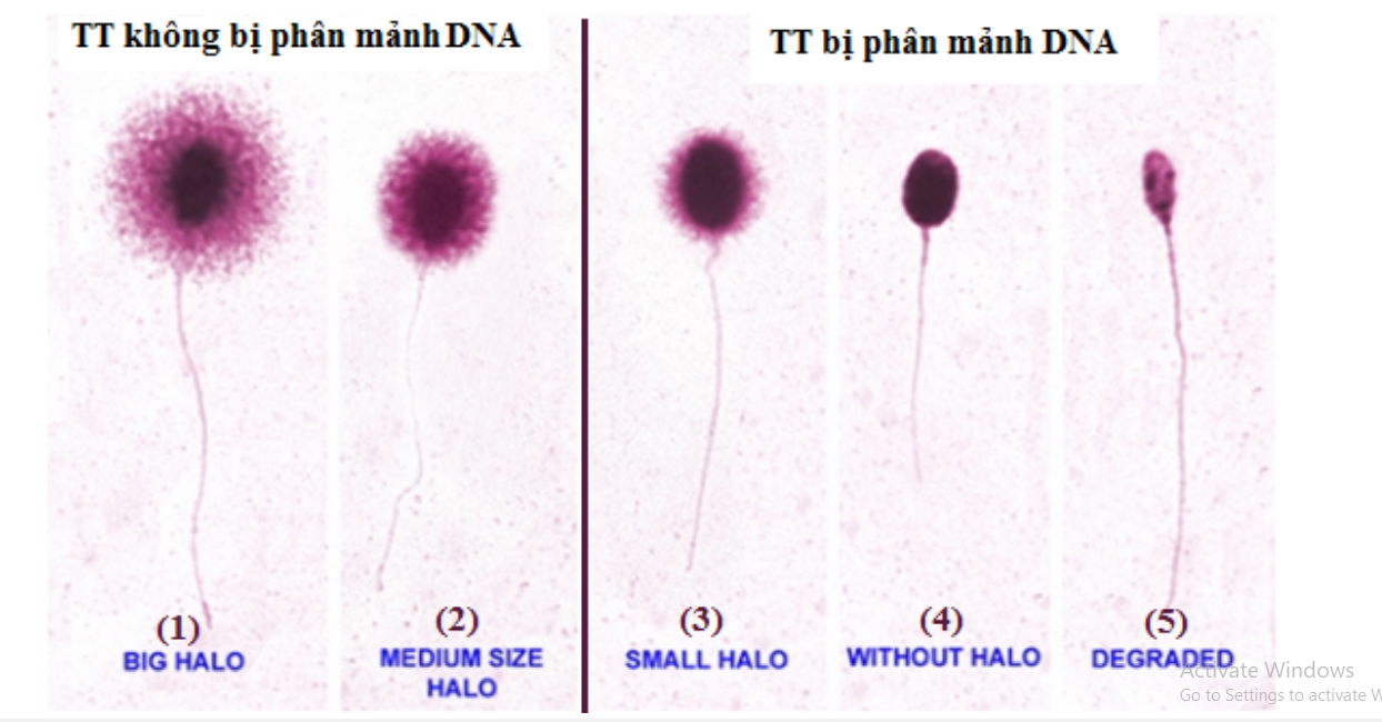 Xét nghiệm phân mảnh DNA tinh trùng trong chẩn đoán hiếm muộn