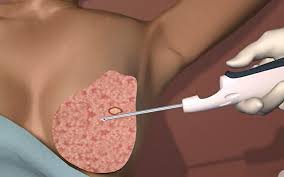 Lâm sàng trong y học là gì?