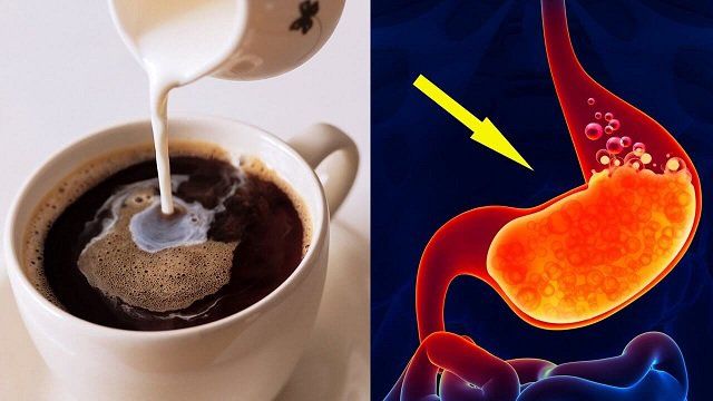Điều trị bệnh Crohn - Cách xoa dịu cơn giận dữ của dạ dày