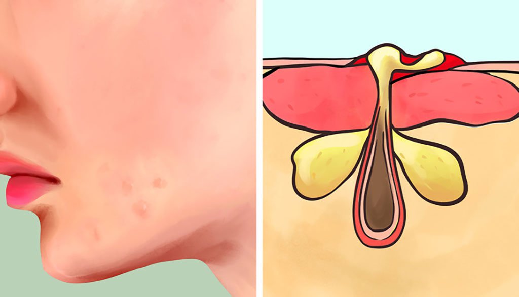 Thuốc Aveeno: Công dụng, chỉ định và lưu ý khi dùng