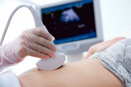 Siêu âm tim thai nâng cao và kế hoạch trước sinh giúp hạn chế tỷ lệ tử vong (Phần 1)