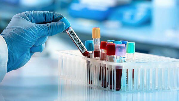 Nồng độ Hemoglobin bao nhiêu là thiếu máu?