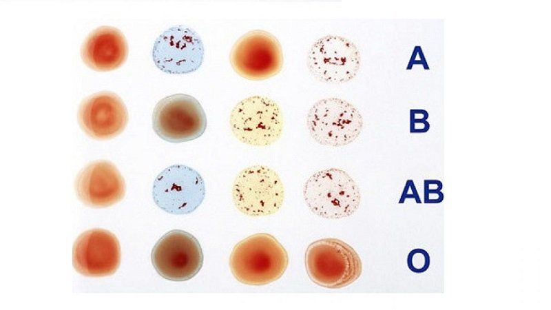 Ý nghĩa y học và vai trò của hệ máu ABO trong truyền máu