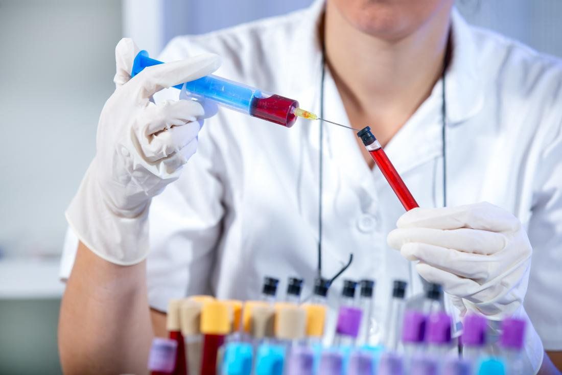 Ý nghĩa xét nghiệm định lượng HCV RNA