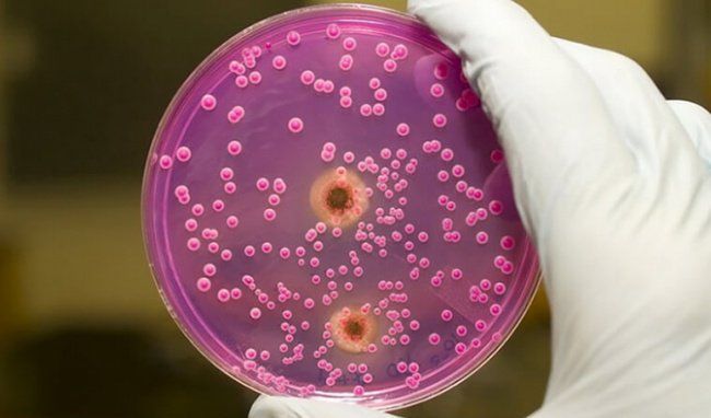 Ý nghĩa xét nghiệm Mycoplasma hominis PCR