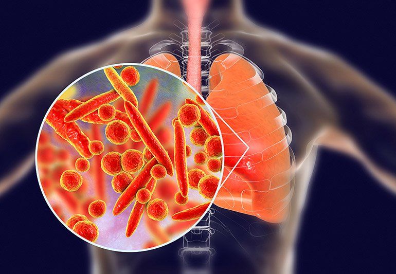 Ý nghĩa xét nghiệm Mycoplasma