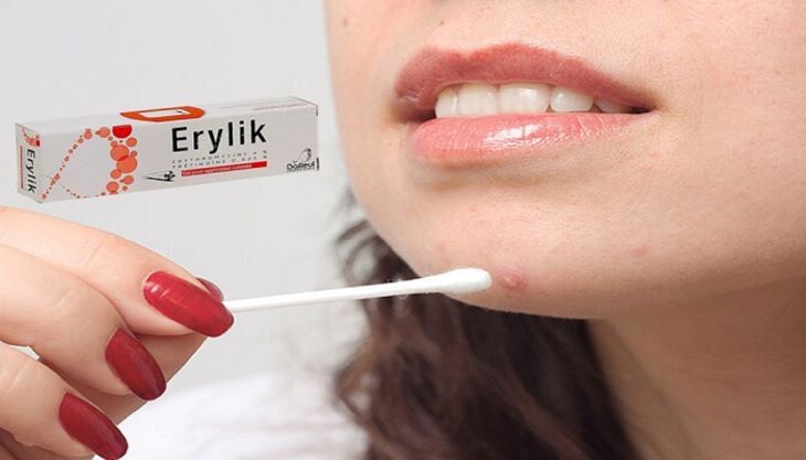 Thuốc Erylik dạng gel điều trị mụn trứng cá: Hướng dẫn sử dụng hiệu quả