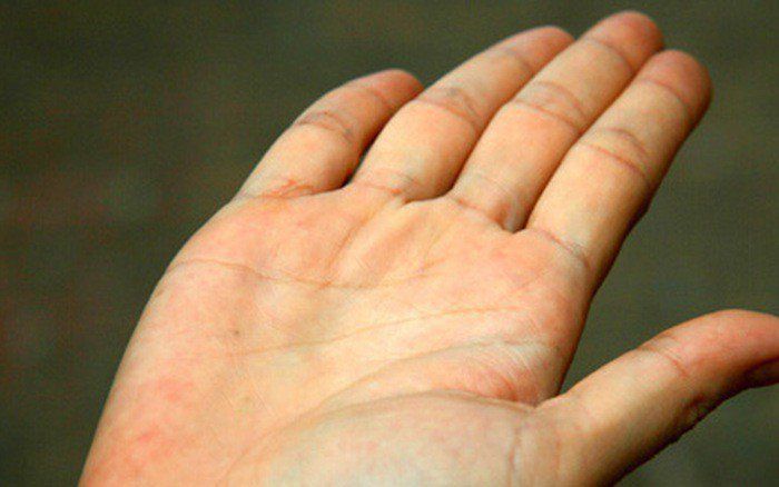 Thuốc Famciclovir: Công dụng, chỉ định và lưu ý khi dùng