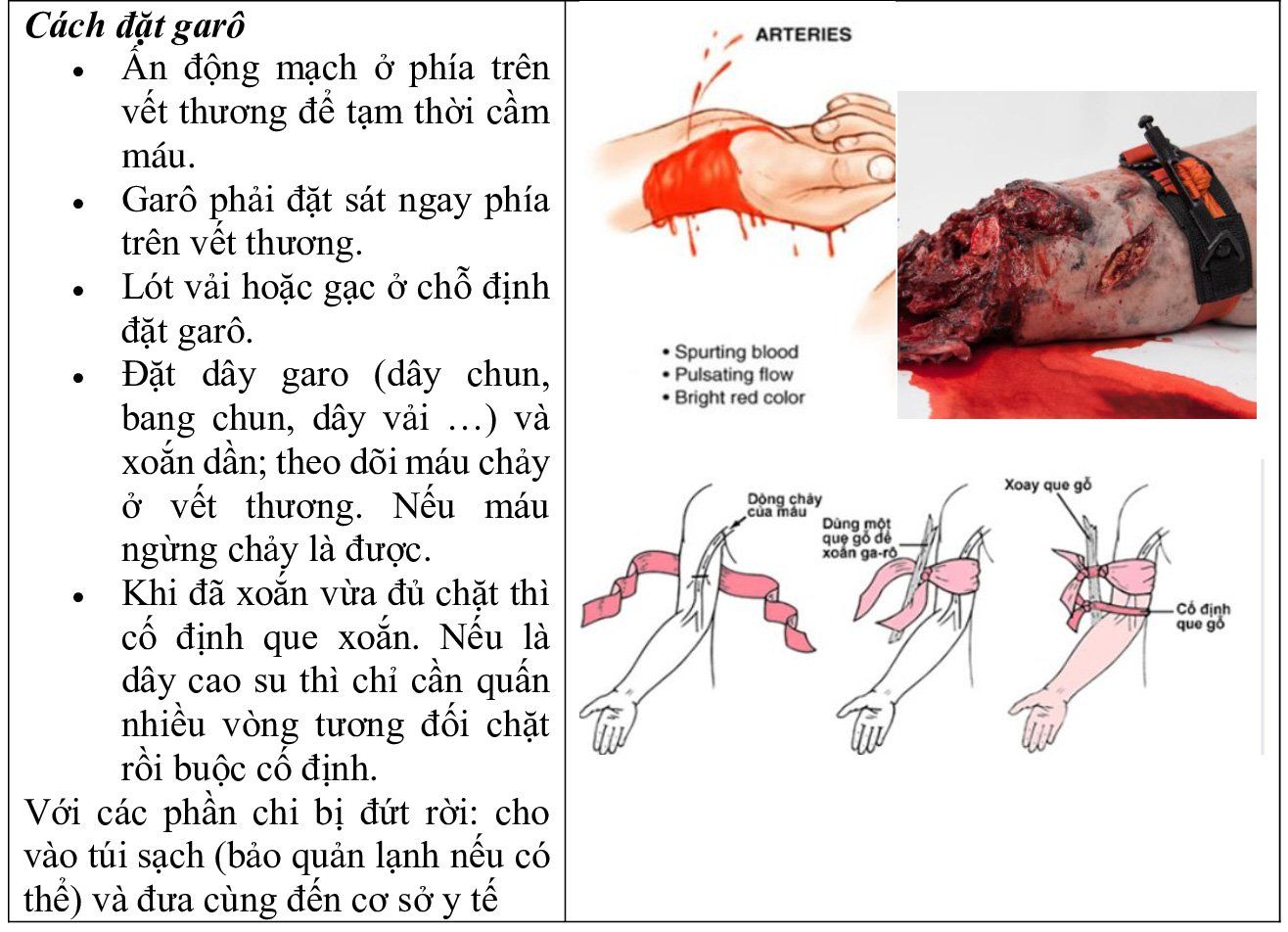 Sơ cứu chảy máu (cầm máu): Những điều cần biết