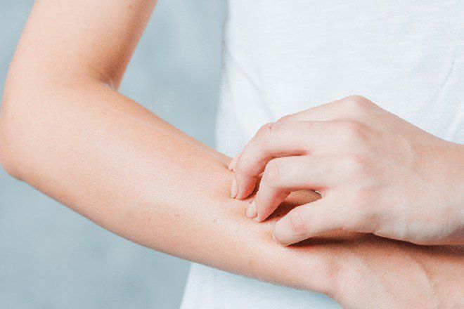 Đối phó với dị ứng quả chanh