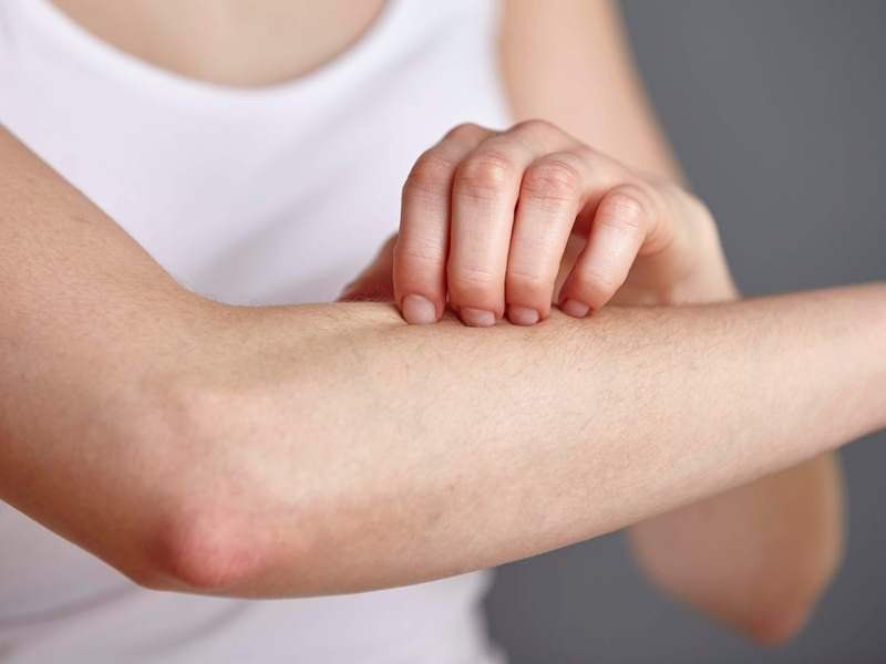 Thuốc Polatuzumab Vedotin-Piiq 140mg: Công dụng, chỉ định và lưu ý khi dùng