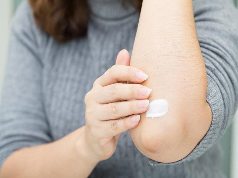 Thuốc Psoriasin: Công dụng, chỉ định và lưu ý khi dùng