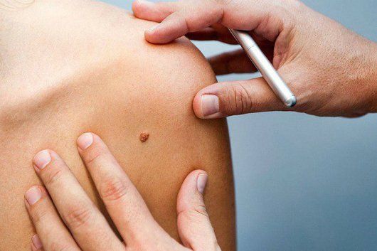 Thuốc Uvadex: Công dụng của thuốc, chỉ định và lưu ý khi dùng thuốc