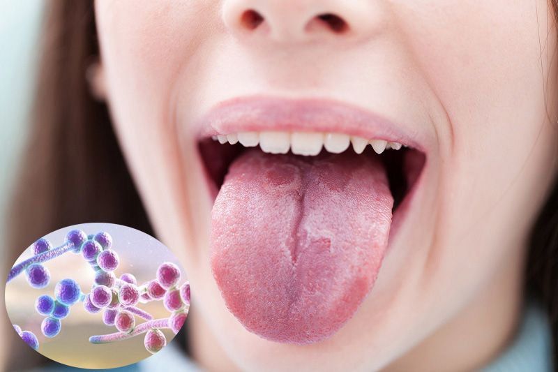 Thuốc Streptomycin: Công dụng, chỉ định và lưu ý khi dùng