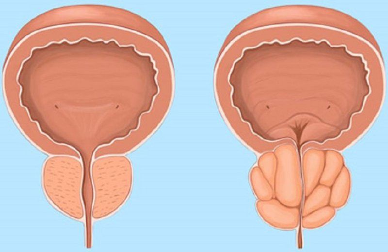 Thuốc Rapaflo: Công dụng, chỉ định và lưu ý khi dùng