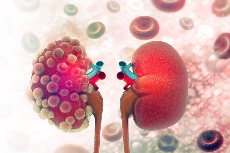 Thuốc Temsirolimus: Công dụng, chỉ định và lưu ý khi dùng