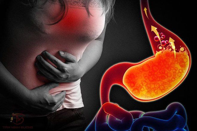 Thuốc Nexium: Công dụng, chỉ định và lưu ý khi dùng