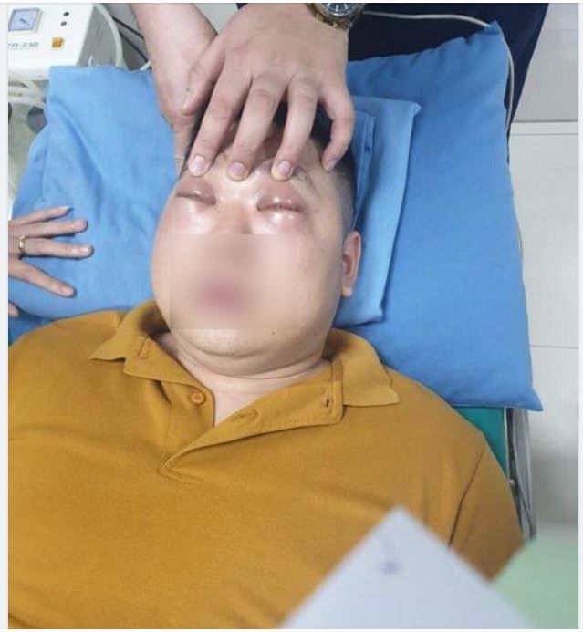 SỐC PHẢN VỆ PHÙ NỀ KHÔNG MỞ ĐƯỢC MẮT VÌ... THÁI 1 CỦ HÀNH