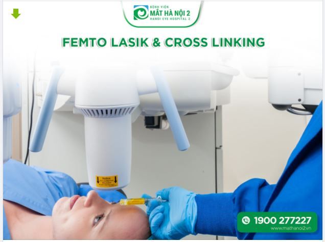 MỔ CẬN FEMTO LASIK KẾT HỢP CROSS LINKING