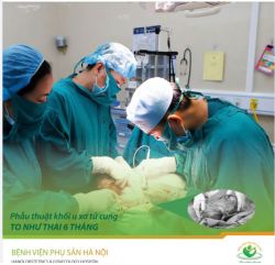 Phẫu thuật khối u xơ tử cung to như thai 6 tháng