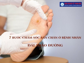 7 bước chăm sóc bàn chân ở bệnh nhân tiểu đường - Bệnh viện Nội Tiết Trung ương