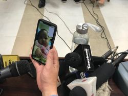 NHẬN BIẾT BƯỚU GIÁP NHÂN TỪ CÁC TRIỆU CHỨNG BAN ĐẦU!