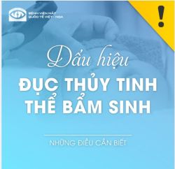 DẤU HIỆU BỆNH ĐỤC THỦY TINH THỂ BẨM SINH