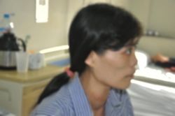 Bệnh Basedow theo y học cổ truyền - Bệnh viện Nội Tiết Trung ương