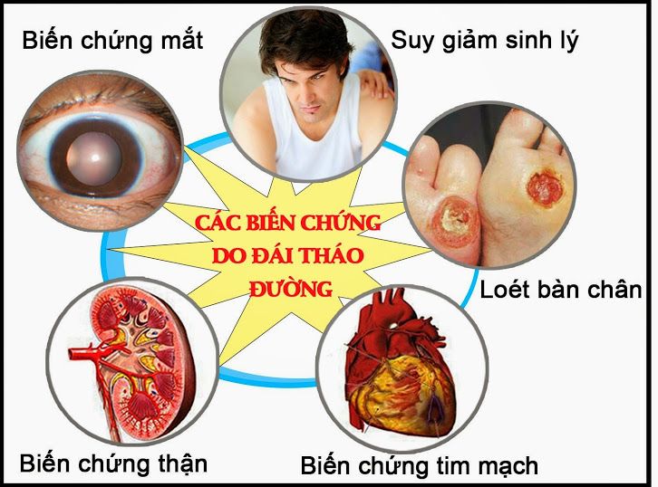 Biến chứng của bệnh đái tháo đường - Bệnh viện Bạch Mai