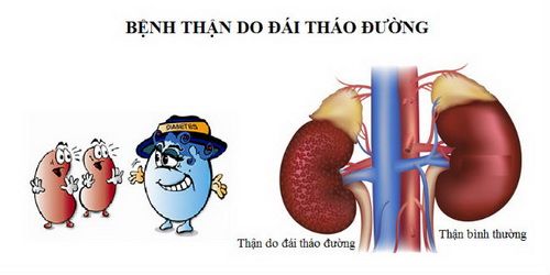 Người bệnh đái tháo đường dễ mắc bệnh thận, vì sao? - Bệnh viện Bạch Mai