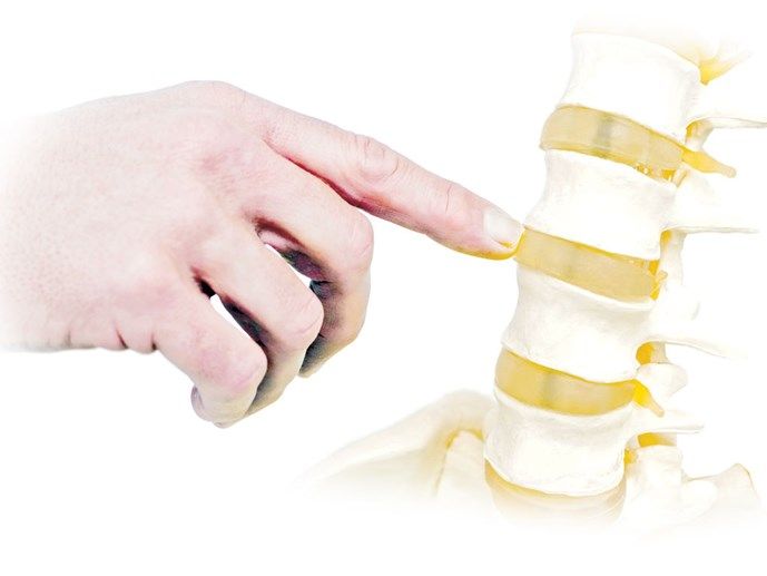 Thay ghép đốt sống nhân tạo - Bệnh viện Bạch Mai