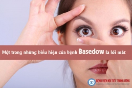 Bệnh Basedow –vCác nguy cơ và biểu hiện bệnh - Bệnh viện Nội Tiết Trung ương