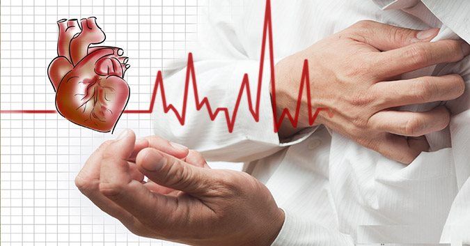 Nhồi máu cơ tim - Một biến chứng nguy hiểm - Bệnh viện Bạch Mai