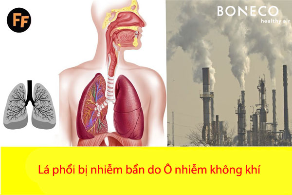 Ô nhiễm không khí ảnh hưởng đến sức khỏe con người như thế nào? - Bệnh viện Bạch Mai