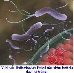 Các thuốc điều trị viêm loét dạ dày - Bệnh viện Bạch Mai