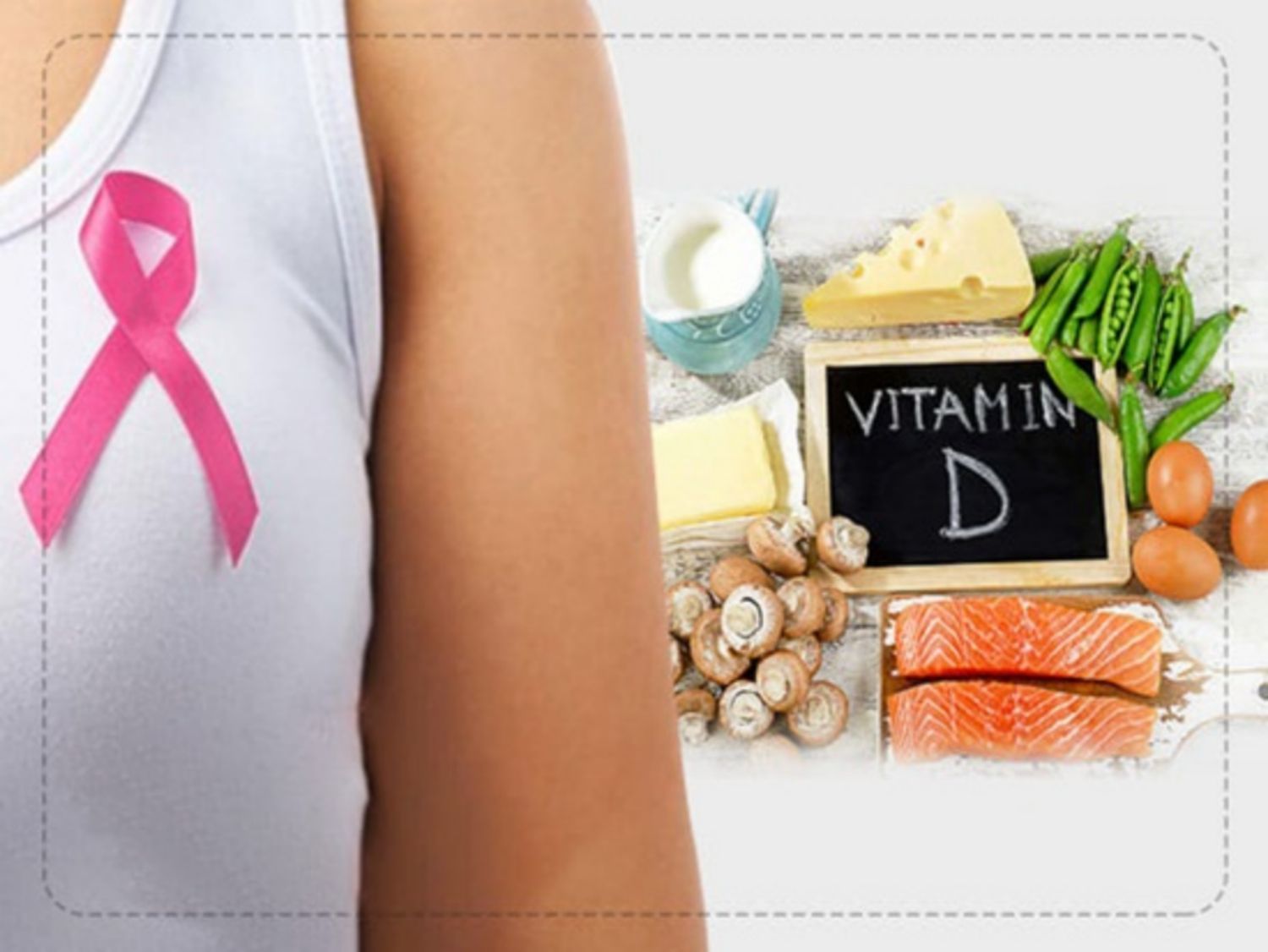 Vitamin D có thể làm giảm nguy cơ ung thư vú