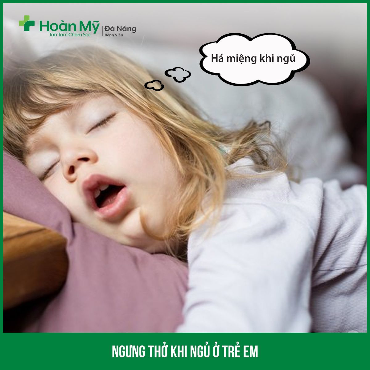 Ngưng thở khi ngủ ở trẻ em - Bệnh viện Hoàn Mỹ Sài Gòn