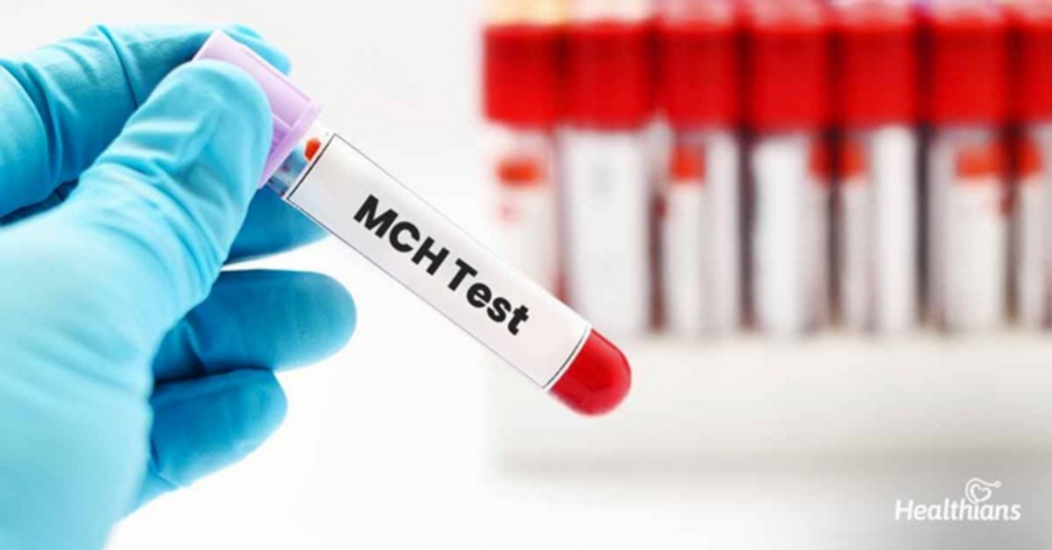 MCH và MCHC có liên quan gì đến tình trạng thiếu máu?
