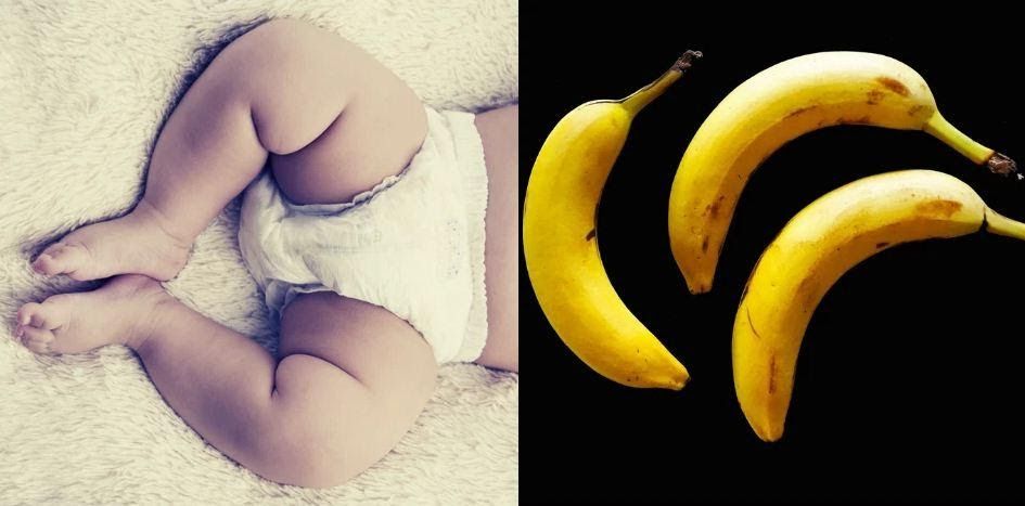 Phẫu thuật thành công cho bé trai có tới 3 dương vật - Nam khoa Penuma