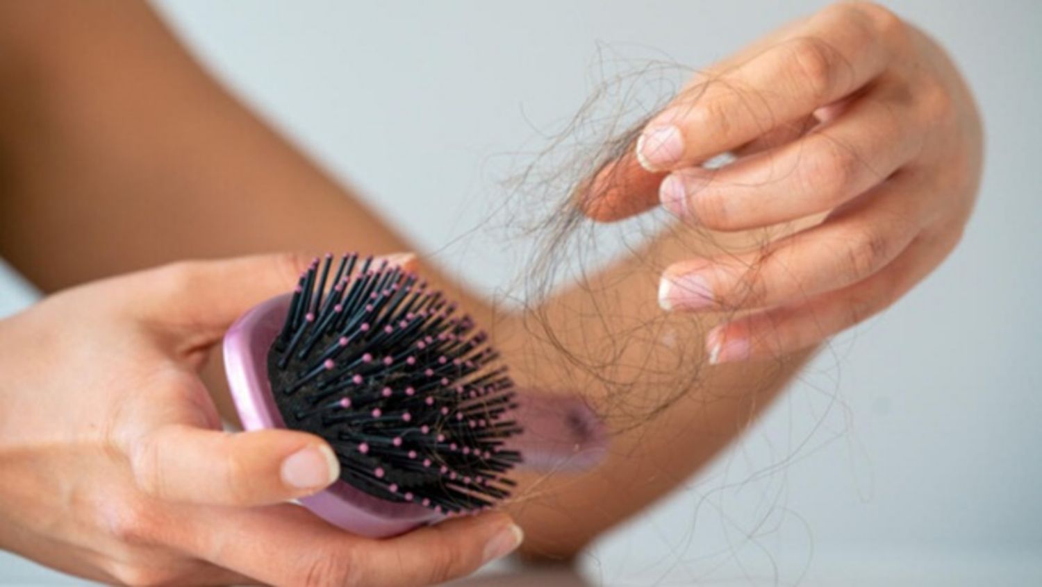 Thiếu sắt có thể gây rụng tóc