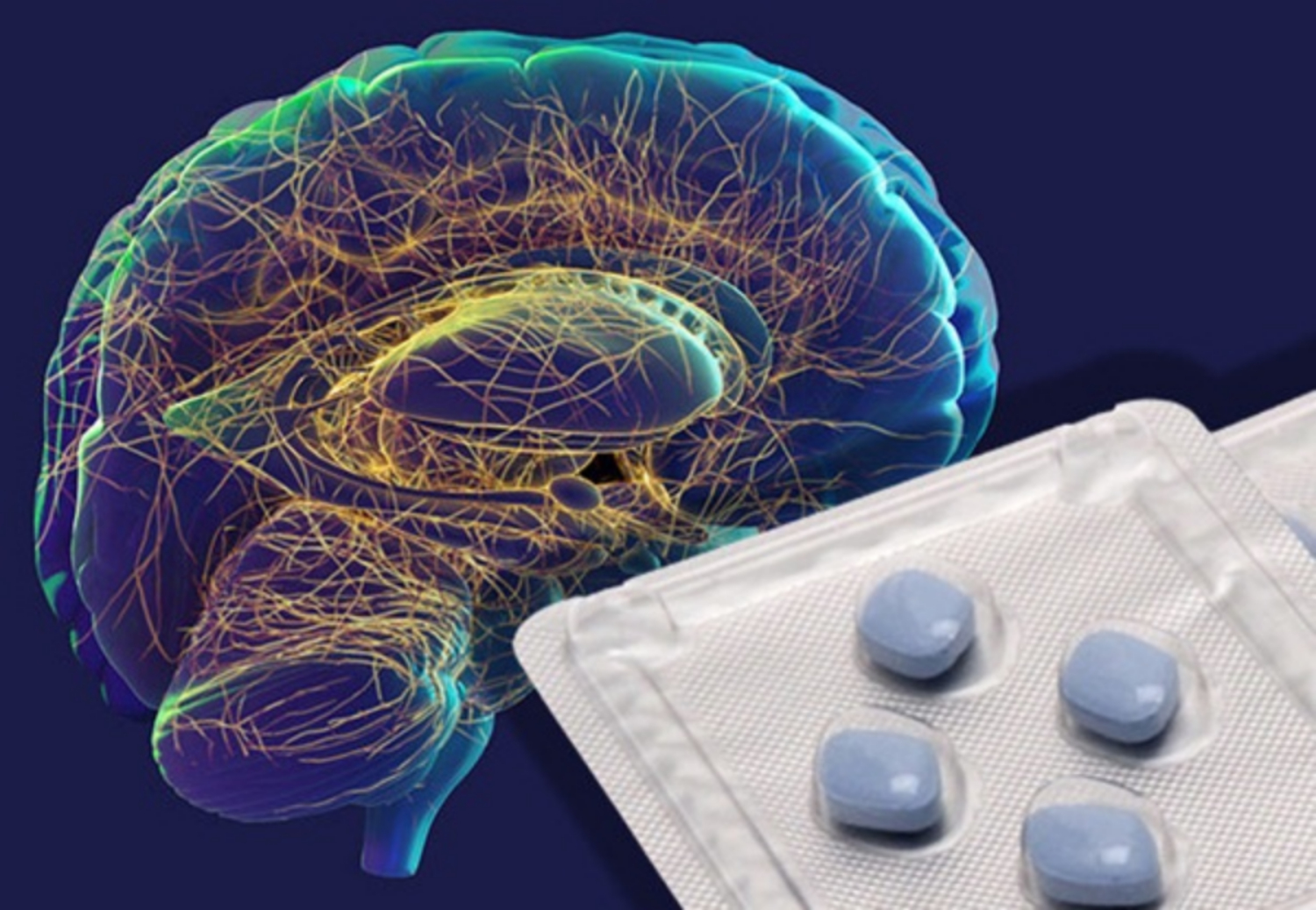 Viagra có thể làm giảm nguy cơ mắc bệnh Alzheimer?