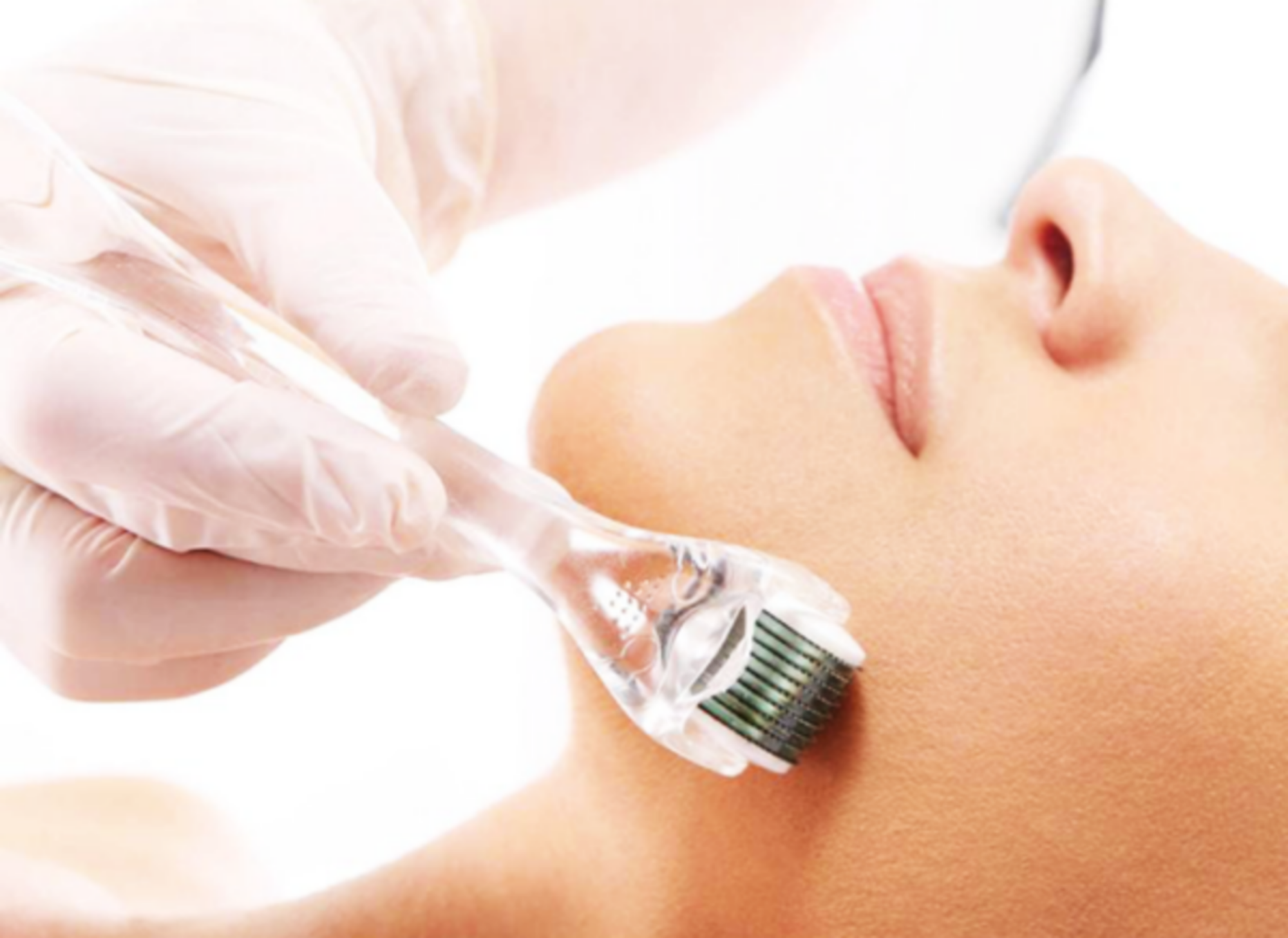 Lăn kim vi điểm: Tác dụng, cách lựa chọn dụng cụ và chăm sóc da